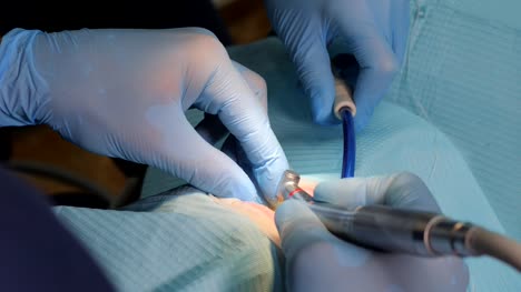 LED-Foto-Aktivator.-Ästhetische-Zahnheilkunde-Veneers.-Dental-Spesialist-bereiten-Patienten-Zähne-für-Keramik-Veneers-mit-speziellen-Werkzeugen.-Medizin,-Zahnmedizin-und-Health-Care-Konzept