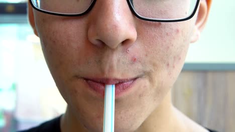 A-young-man-with-acne-on-his-face-drinks-soda-from-the-straw.