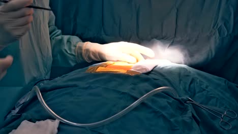 Cutting-the-chest-during-an-operation-on-the-heart.-Surgical-breast-opening-during-surgical-operation.
