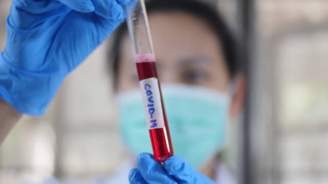 Médico-sosteniendo-el-tubo-de-ensayo-en-sangre-cóvido-19-en-el-laboratorio
