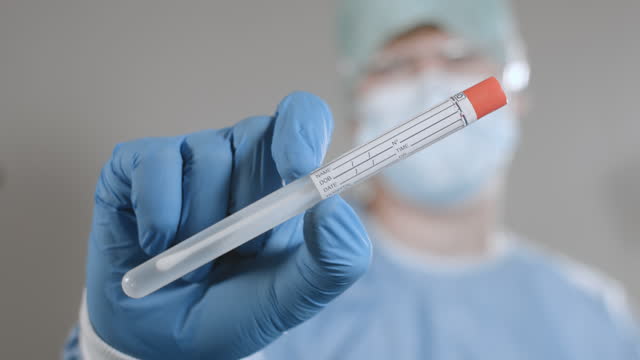 Virologe-mit-Coronavirus-Test