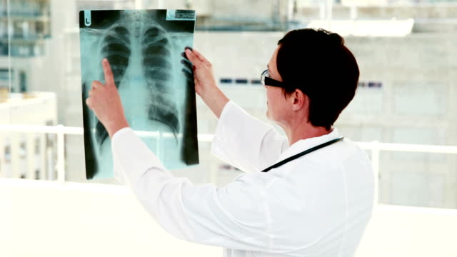 Doctor-analyzing-xray-results