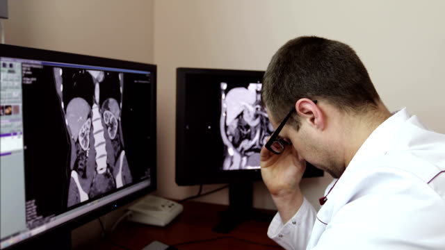 4K-müde-Arzt-nahm-seine-Brille-beim-Sitzen-auf-den-Monitoren-mit-einer-Röntgenuntersuchung.