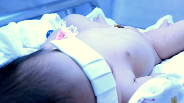 Newborn-baby-lying-in-a-glass-container-under-the-uv-light-in-hospital-post-delivery-room