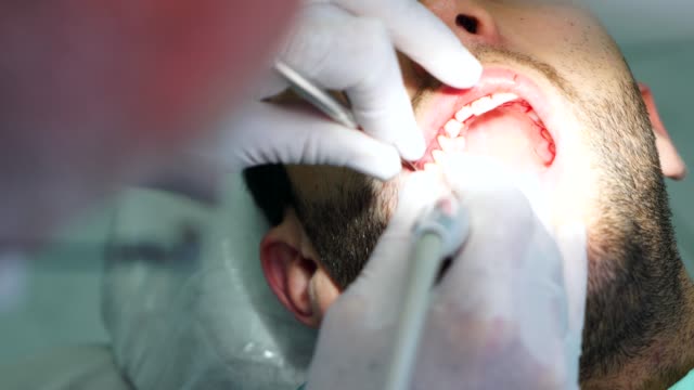 Zahnarzt-Bohren-einen-Männer-Zahn