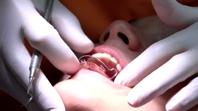 Dentist-examining-a-patient's-teeth-in-dentist-office