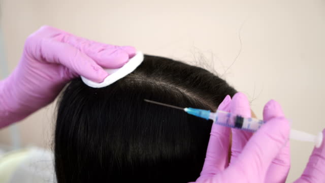 Needle-mesotherapy.-Cosmetic-been-injected-in-woman's-head.-Thrust-to-strengthen-hair-and-their-growth