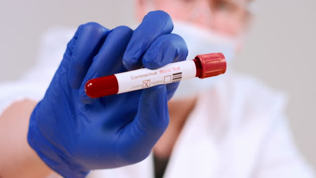 Coronavirus-infected-blood-sample-tube