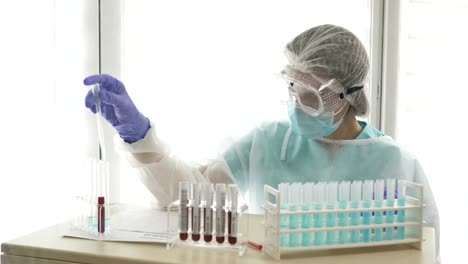 Bluttest-für-covid-19.-Weibliche-Laborassistentin-führt-eine-Analyse-im-Labor-durch,-verwendet-Reagenzgläser-und-Pipetten
