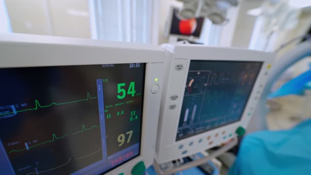 Zwei-medizinische-Monitore-in-der-Notaufnahme.-EKG-Monitor-im-Operationsraum.-Moderne-medizinische-Geräte,-um-den-Zustand-des-Patienten-auf-der-Intensivstation-zu-zeigen.