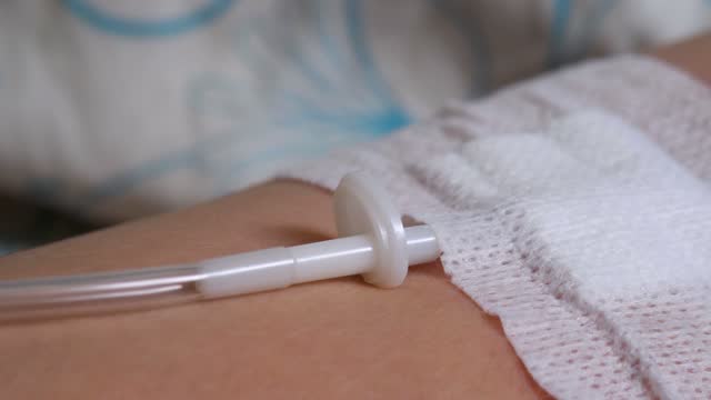 Intravenous-injection-for-sick-unrecognizable-person-on-patient-bed