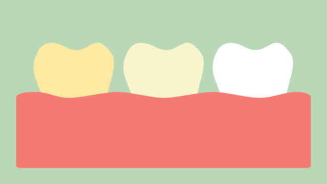 gelb,-weißer-Zahn,-Zahnweiß-Konzept