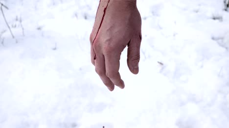 Blut-rinnt-aus-der-Hand-in-den-Schnee.
