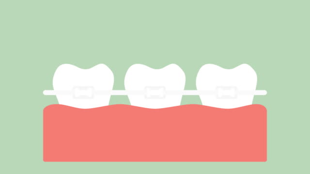 los-dientes-ortodoncicos-o-brackets-dentales