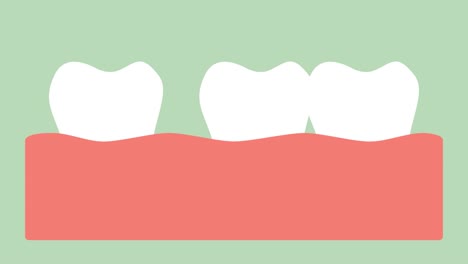 Abstand-Zähne-(Diastema),-Abstand-zwischen-den-Zahn-im-Mund