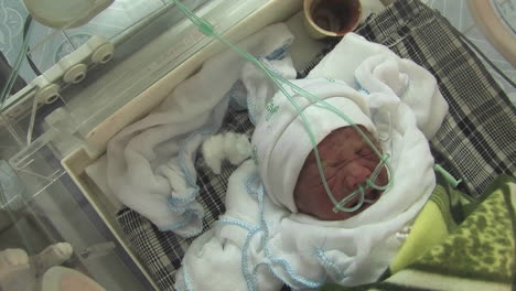 A-premature-baby-in-an-incubator-cries