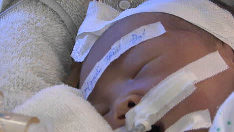 Newborn-baby-sleeping-in-a-hospital