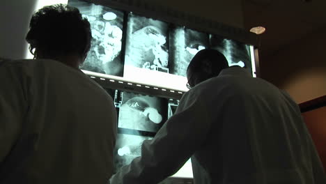 Medical-professionals-evaluate-xrays-on-a-wall-light-box