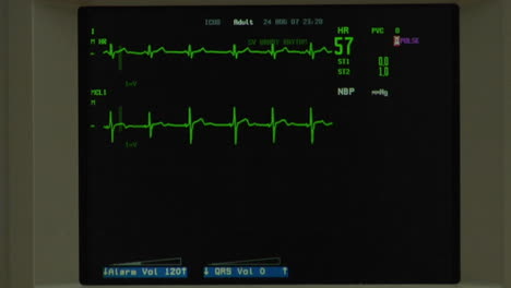 A-normal-EKG-appears-on-a-screen