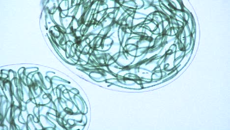 Microscopic-view-of-sacks-or-bubbles-containing-chains-of-blue-green-algae