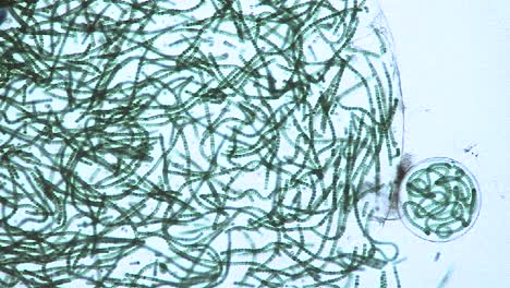Vista-Microscópica-De-Sacos-O-Burbujas-Que-Contienen-Cadenas-De-Algas-Verde-Azuladas-2