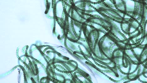 Microscopic-view-of-sacks-or-bubbles-containing-chains-of-blue-green-algae-3