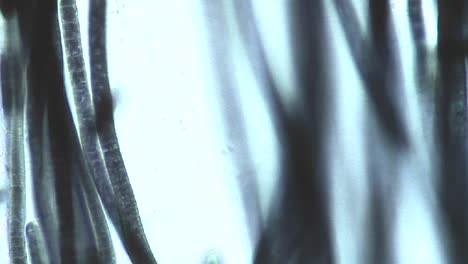 Mikroskopische-Ansicht-Von-Phormidium-Blaualgen