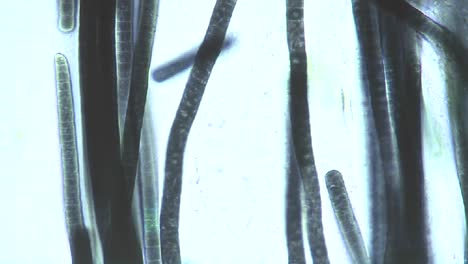 Microscopic-view-of-Phormidium-blue-green-algae-1