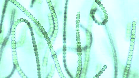 Mikroskopische-Ansicht-Von-Algenketten-Diese-Cyanobakterien-Microcystis-Sp-Sind-Eine-Art-Von-Blaugrünen-Algen,-Die-Im-Süßwasser-Leben