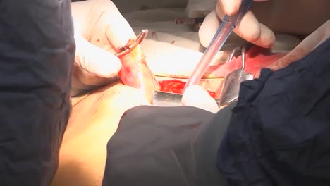 A-Medical-Clinic-In-Afghanistan-Performs-Surgeries